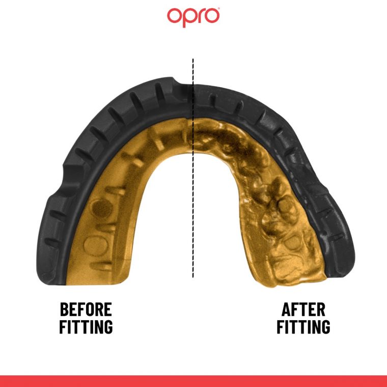 OPRO GOLD MOUTHGUARD FOR BRACES